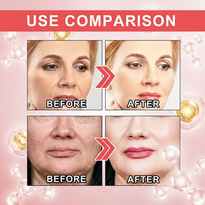 REVERSE Wrinkle Lift Cream