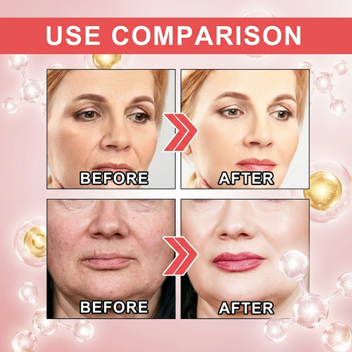 REVERSE Wrinkle Lift Cream